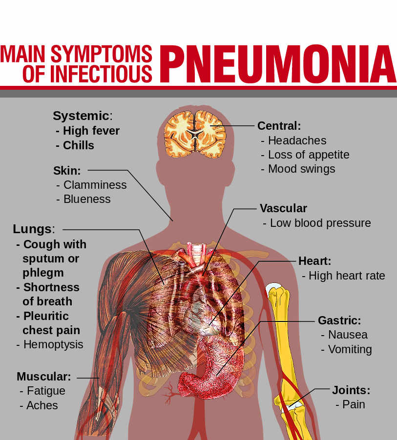 Pneumonia A Big Killer  Healthtalk01-8937
